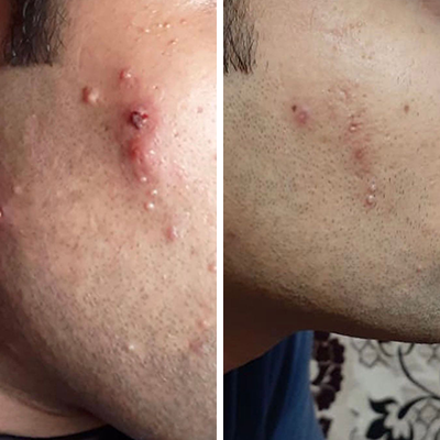 Life Changing Results